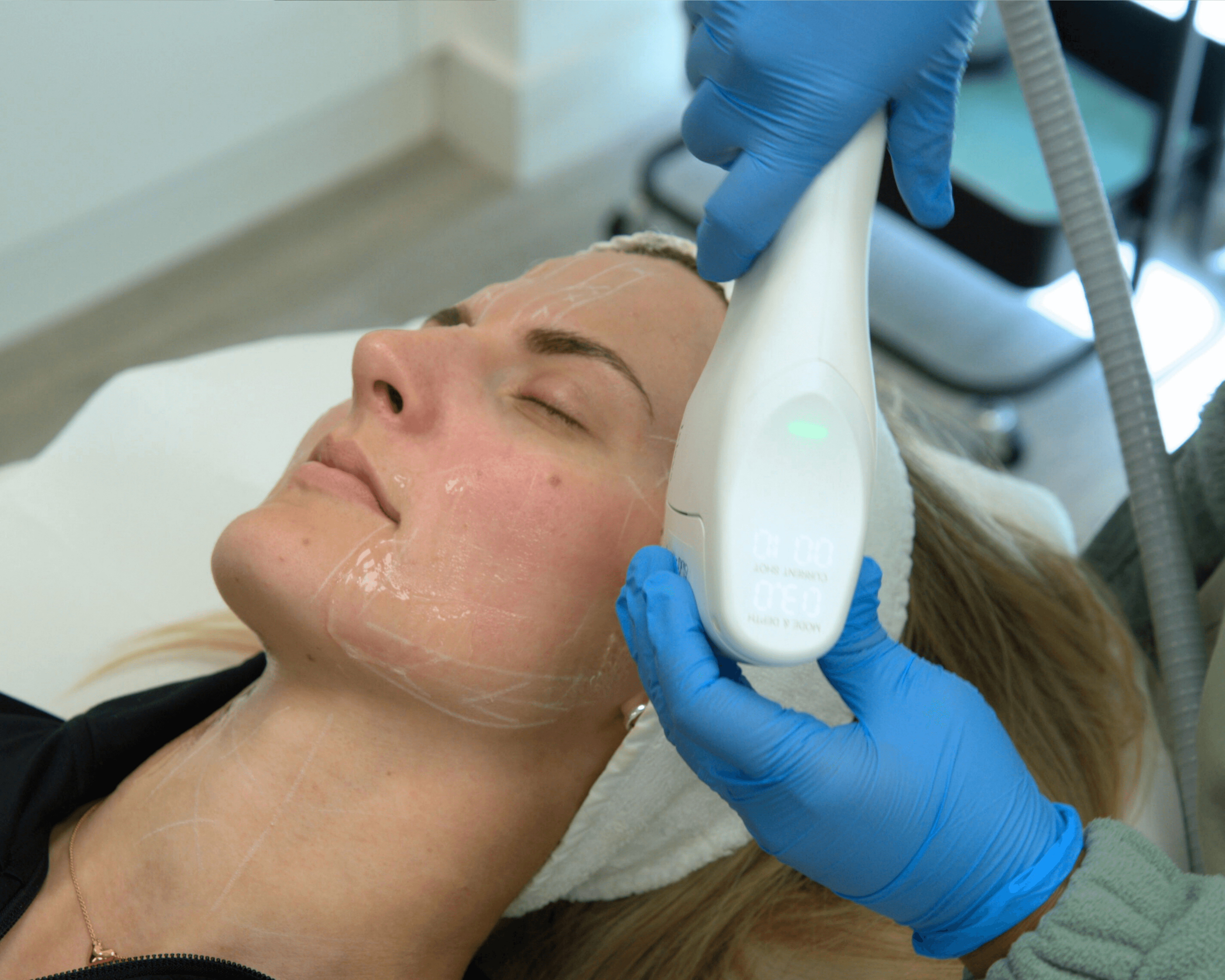 non-surgical-facelift-abu-dhabi