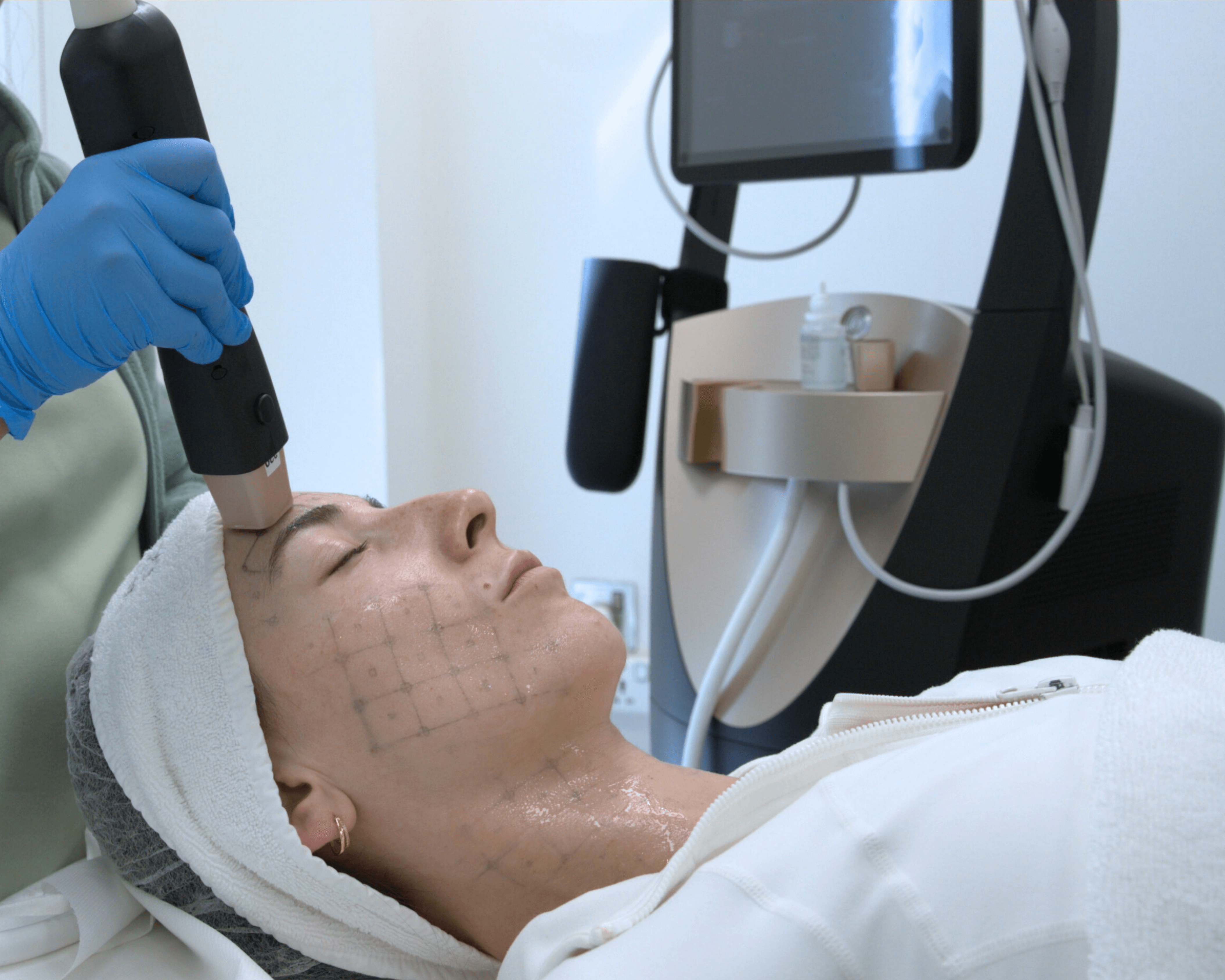 skin-tightening-abu-dhabi