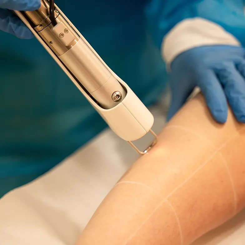 laser-hair-removal-2