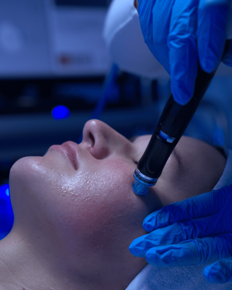 HydraFacial treatment at skincare clinic in Abu Dhabi