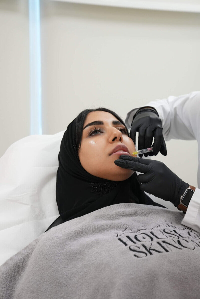 Dermal Filler Treatment Areas Dermal filler treatment areas including lips, cheeks, and jawline enhancement in Abu Dhabi