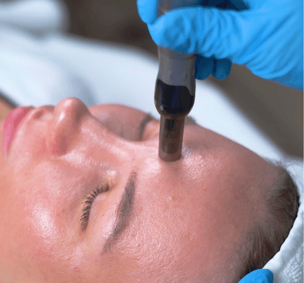 Dermapen_Microneedling_Abu_Dhabi
