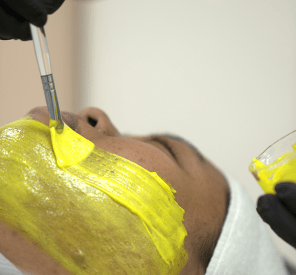 Medical_Grade_Peeling_Abu_Dhabi