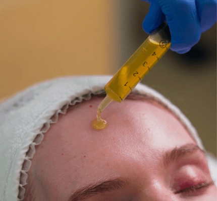 PRP Skin and Hair Treatment Abu Dhabi Clinic PRP hair loss and skin treatment at House of Skincare Abu Dhabi Yas Island