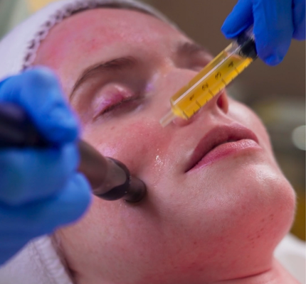 PRP_Treatment_Abu_Dhabi