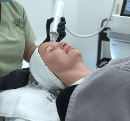 potenza microneedling