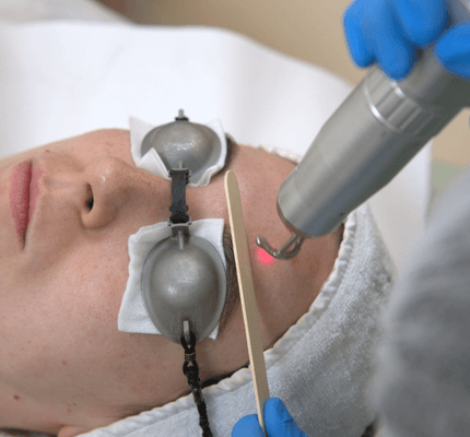 Soft_light_Laser_Hair_Bleaching_Abu_Dhabi