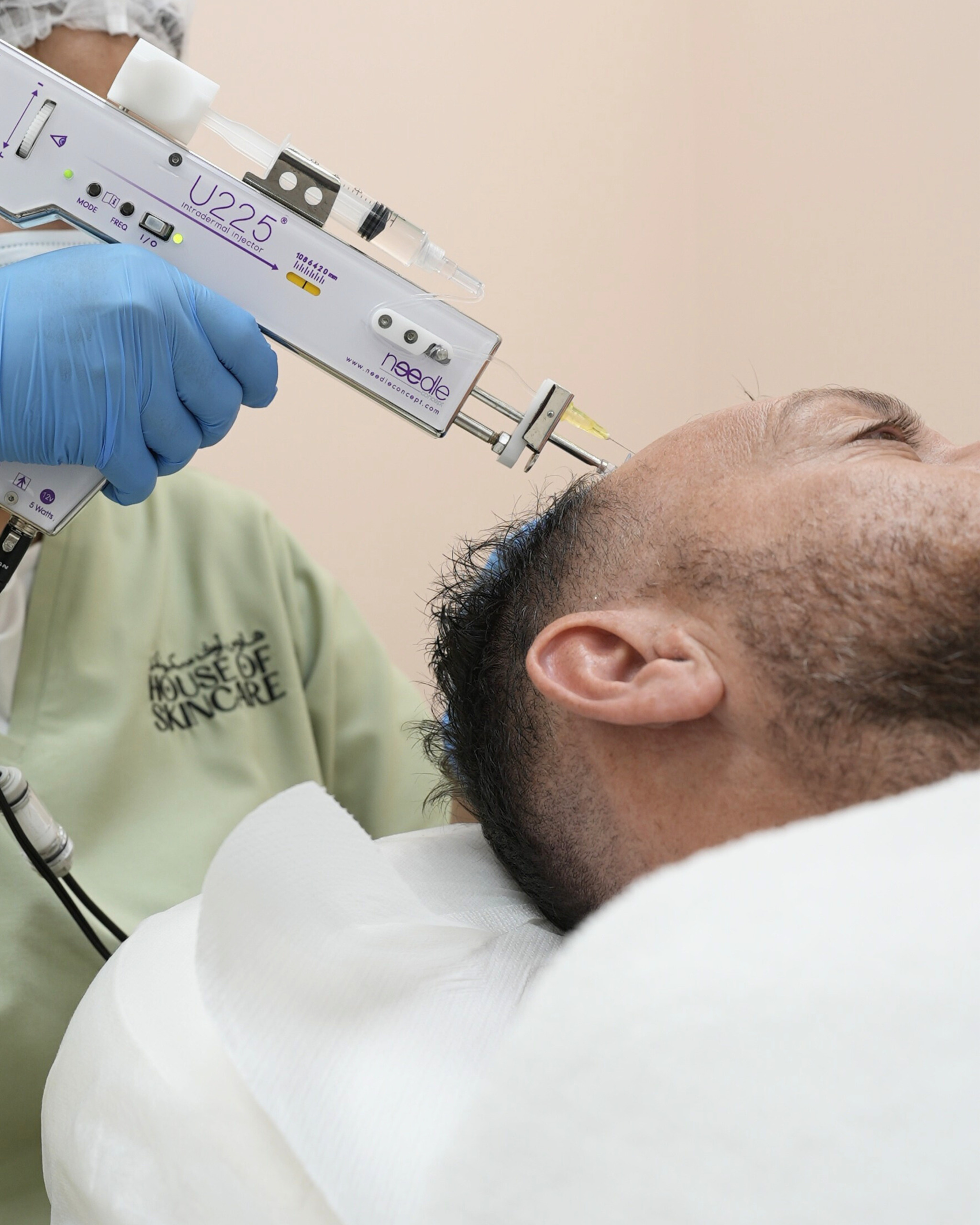 PRP for Hair Loss in Abu Dhabi: A Dermatologist's Guide PRP scalp injection for hair loss treatment on male patient at House of Skincare Yas Island Abu Dhabi