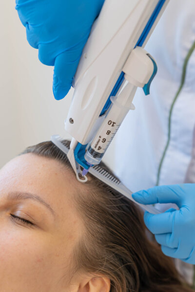Mesogun automated scalp injection for hair loss treatment on female patient at House of Skincare Abu Dhabi