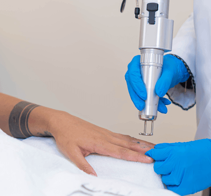Laser Tattoo Removal Abu Dhabi — House of Skincare Clinic Tattoo removal laser Abu Dhabi — professional laser tattoo removal treatment